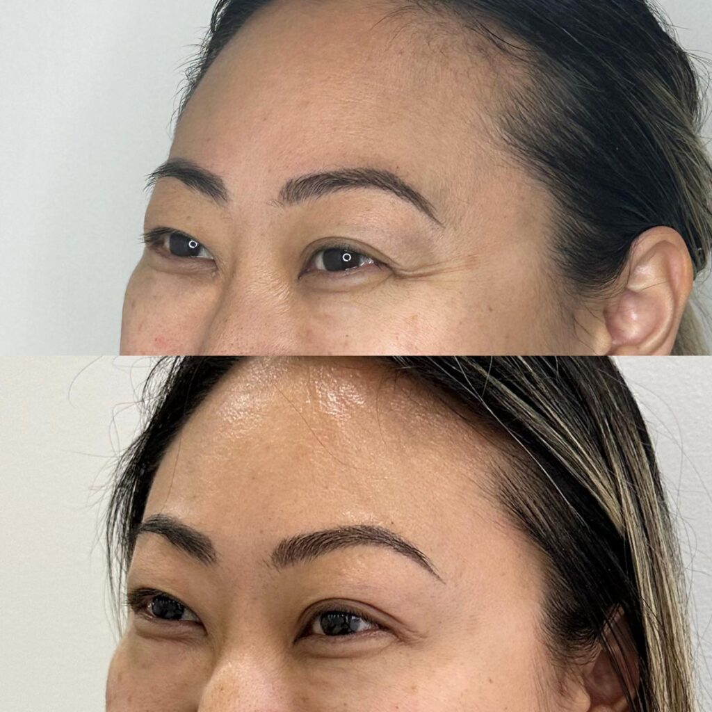 Woman with wrinkles