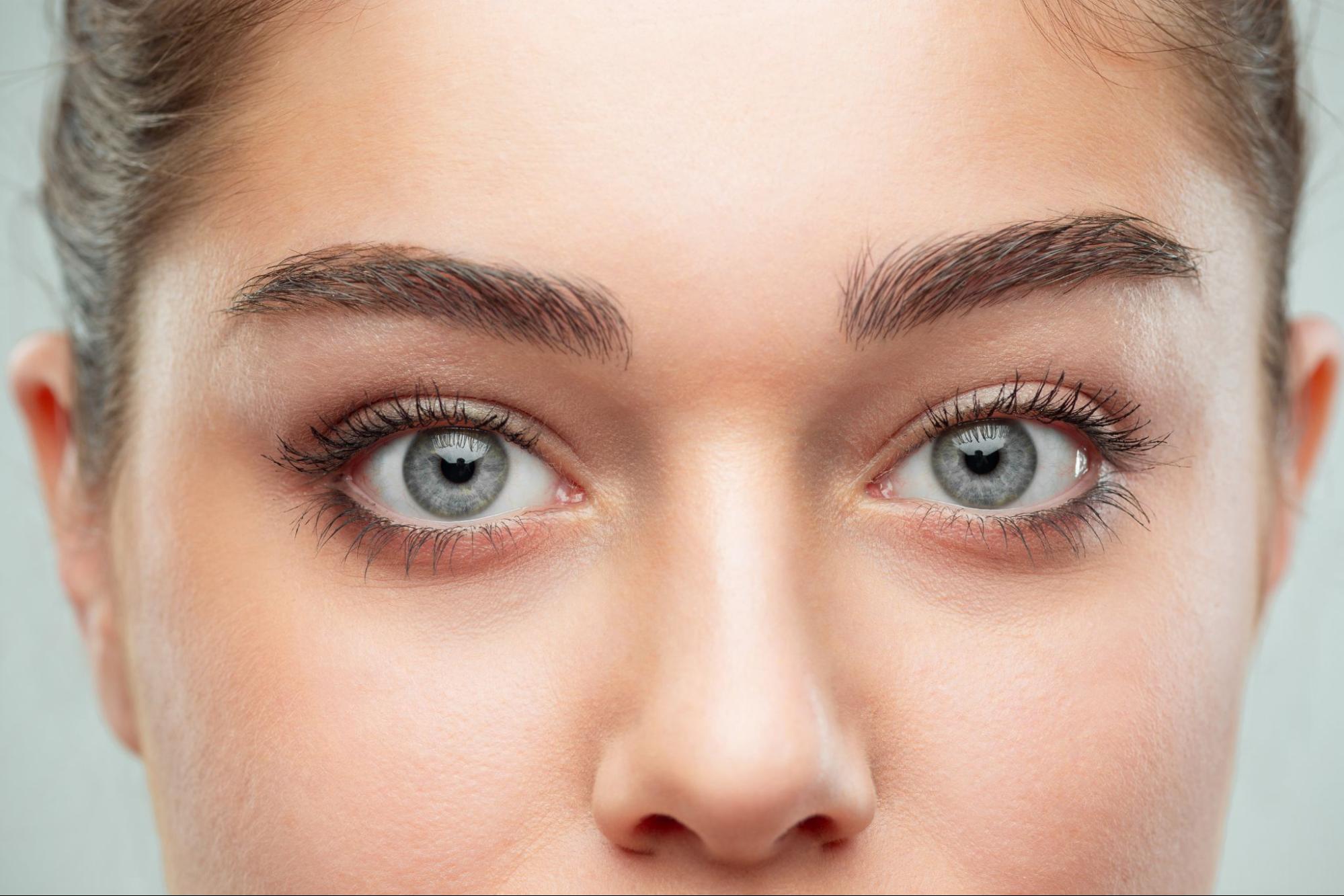 womans eyes with dark circles