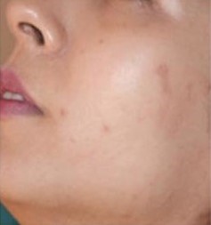 image after treatment
