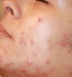 image before treatment